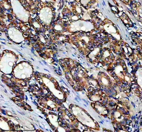 IHC analysis of FAM129A/NIBAN1 using anti-FAM129A/NIBAN1 antibody (A07791-3)