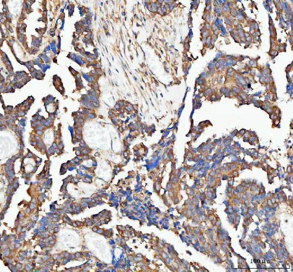 a07792 2 paip1 primary antibodies ihc testing 2