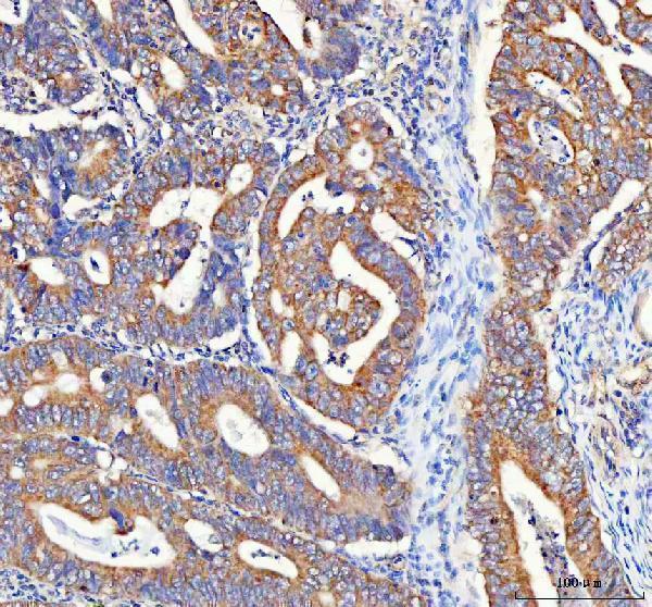 a07792 2 paip1 primary antibodies ihc testing 3