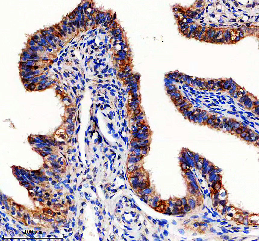 a07794 lztfl1 primary antibodies ihc testing 1