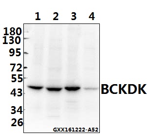 Western blot (WB) analysis of BCKDK (E41) polyclonal antibody at 1:500 dilution
Lane1:C6 whole cell lysate(40ug)
Lane2:AML-12 whole cell lysate(40ug)
Lane3:HEK293T whole cell lysate(40ug)
Lane4:L02 whole cell lysate(40ug)