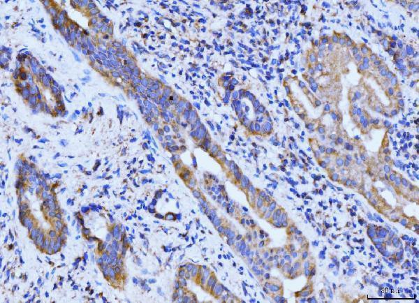  IHC analysis of BCKDK using anti-BCKDK antibody (A07798-2)
