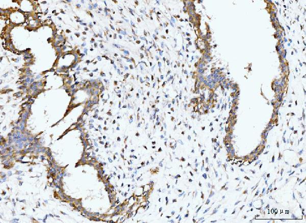  IHC analysis of BCKDK using anti-BCKDK antibody (A07798-2)