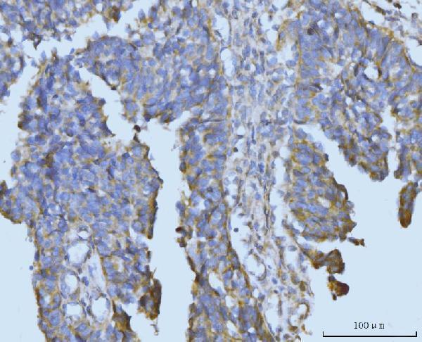 a07798 2 bckdk primary antibodies ihc testing 4