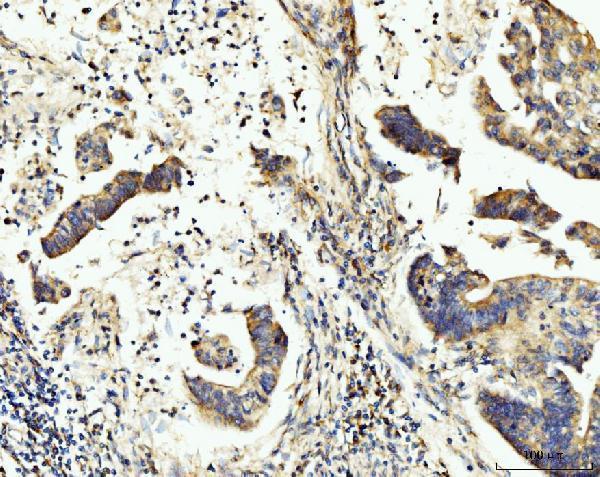 a07798 2 bckdk primary antibodies ihc testing 5