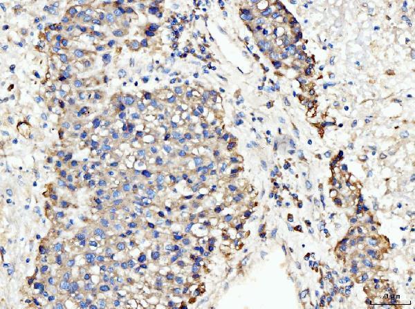 a07798 2 bckdk primary antibodies ihc testing 6
