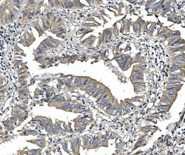 a07800 1 pde6a primary antibodies ihc testing 2