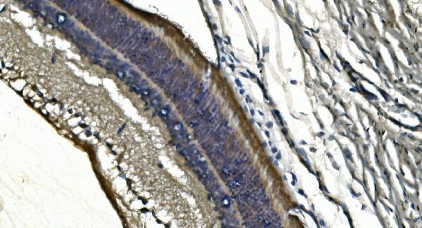 a07800 1 pde6a primary antibodies ihc testing 3