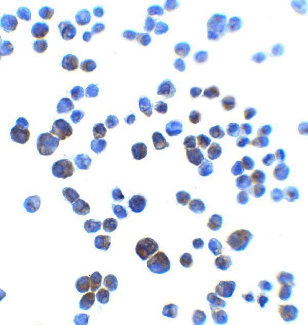 Immunocytochemistry of AJAP1 in K562 cells with AJAP1 at 2