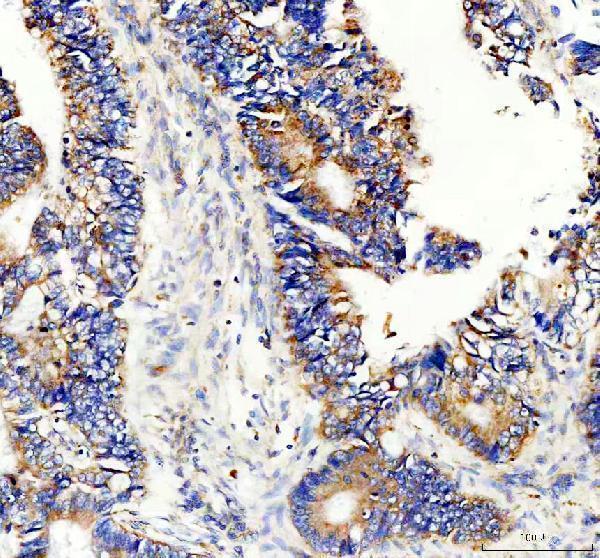 IHC analysis of ATG10 using anti-ATG10 antibody (A07803-2)