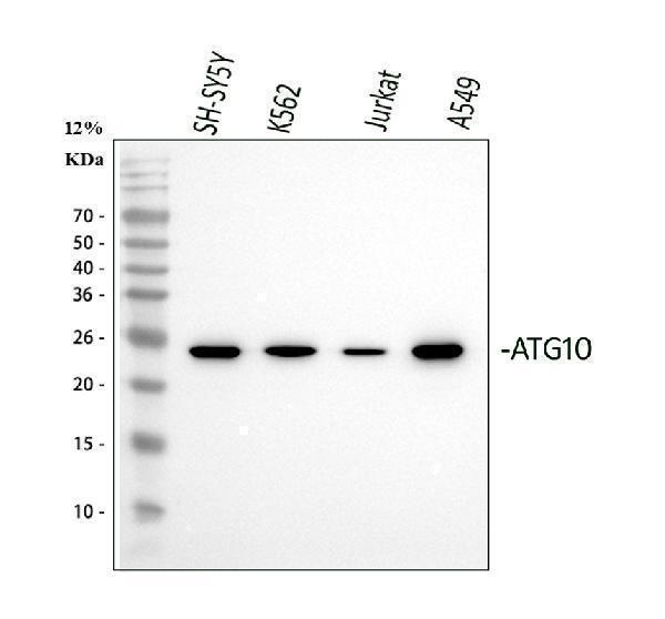Western blot analysis of ATG10 using anti-ATG10 antibody (A07803-2)