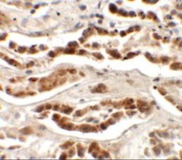 Immunohistochemistry of LZTS2 in human kidney tissue with LZTS2 antibody at 2