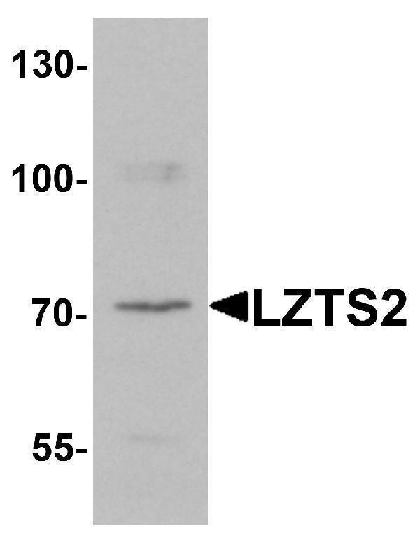 Western blot analysis of LZTS2 in human kidney tissue lysate with LZTS2 antibody at 1 μg/mL