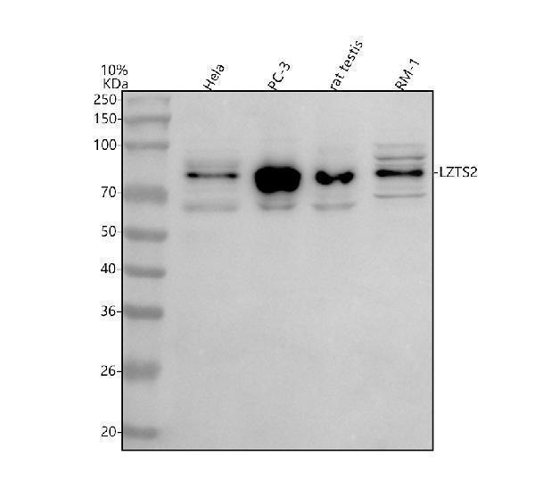  Western blot analysis of LZTS2 using anti-LZTS2 antibody (A07806-3)