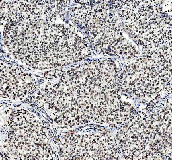  IHC analysis of NCOA5 using anti-NCOA5 antibody (A07810-2)