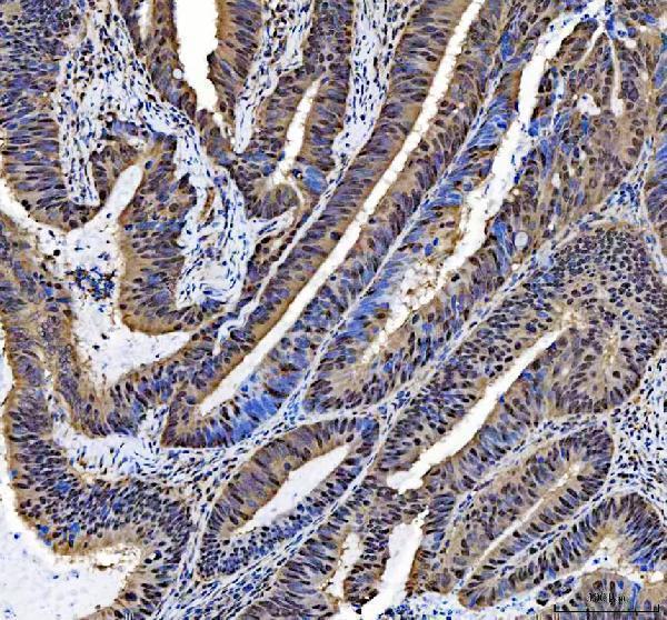  IHC analysis of NCOA5 using anti-NCOA5 antibody (A07810-2)