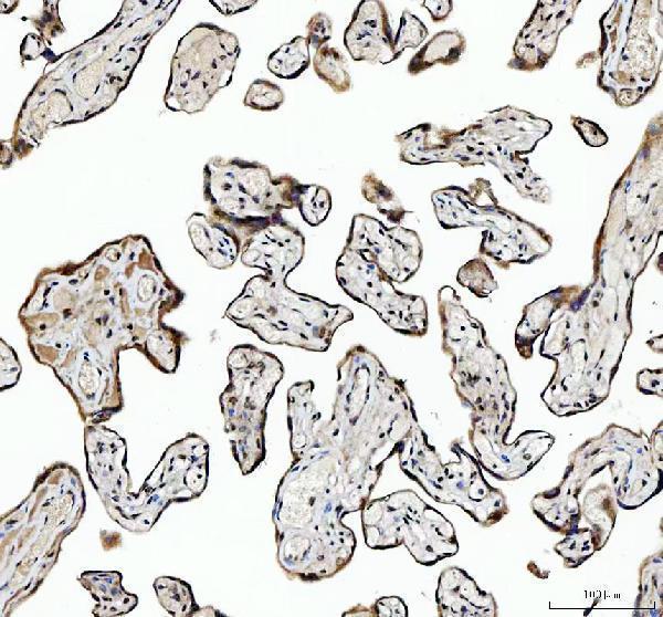 a07810 2 ncoa5 primary antibodies ihc testing 4