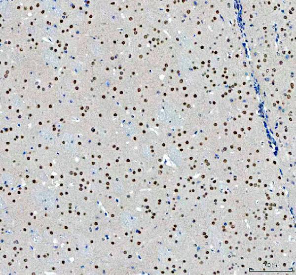 a07810 2 ncoa5 primary antibodies ihc testing 5