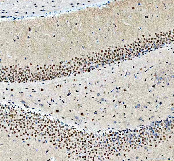 a07810 2 ncoa5 primary antibodies ihc testing 6