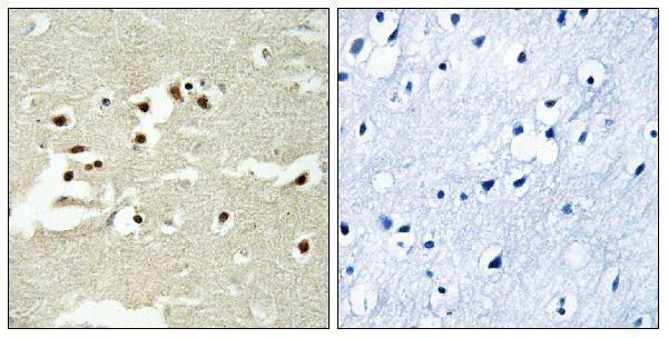 Immunohistochemistry analysis of paraffin-embedded human brain tissue, using NCOA5 Antibody
