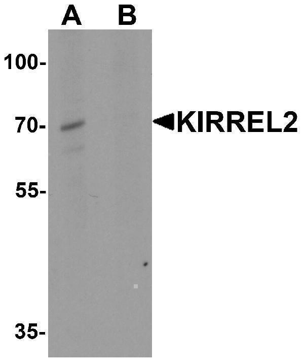 Western blot analysis of KIRREL2 in 293 cell lysate with KIRREL2 antibody at 1 μg/ml in (A) the absence and (B) the presence of blocking peptide