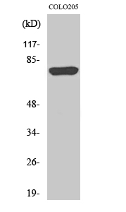 a07813 1 acsl6 primary antibodyes wb testing 1