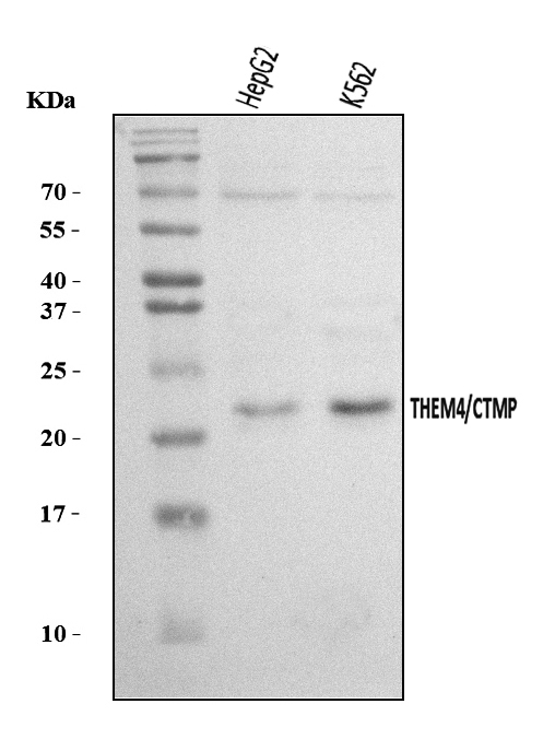  Western blot analysis of THEM4 using anti-THEM4 antibody (A07814-1)