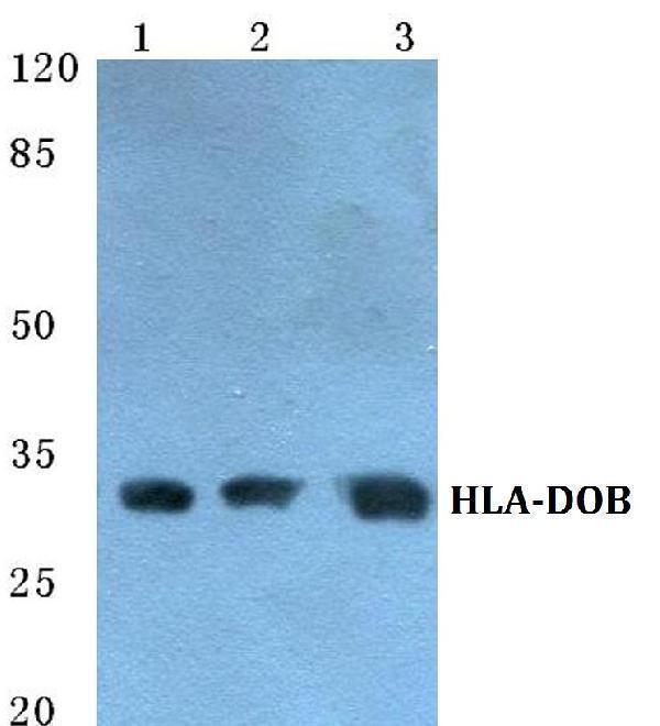 a07815 1 hla dob primary antiboties wb testing 1