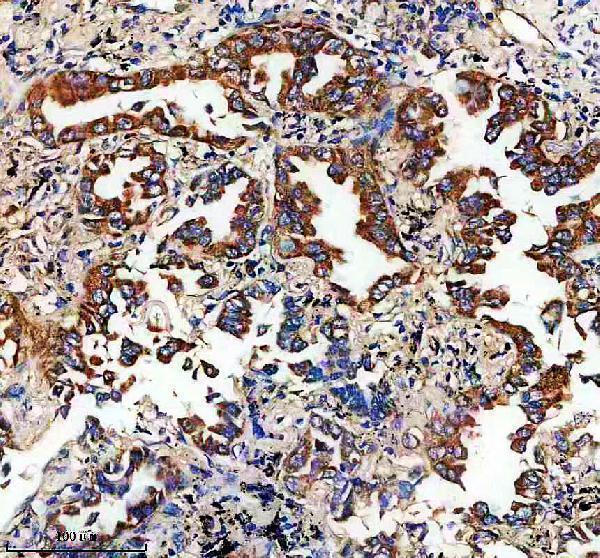 IHC analysis of ECH1 using anti-ECH1 antibody (A07818-1)
