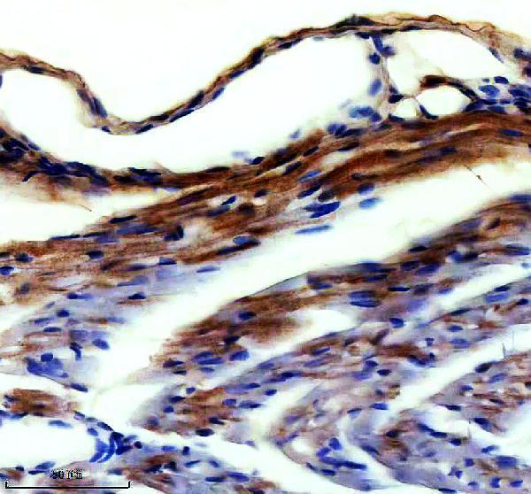 IHC analysis of ECH1 using anti-ECH1 antibody (A07818-1)