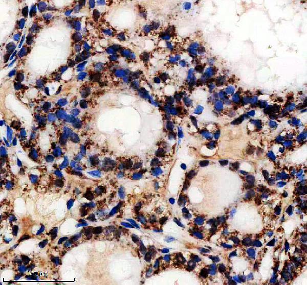 a07818 1 ech1 primary antibodies ihc testing 4