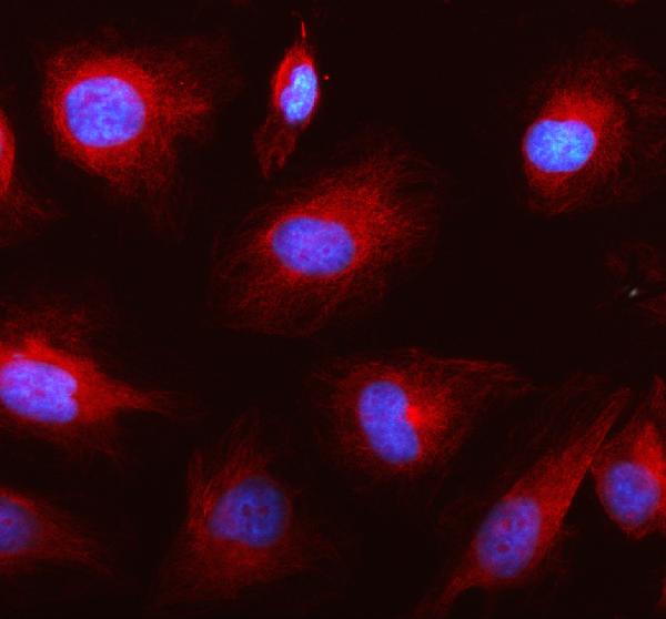 a07820 1 itga11 primary antibodies if testing 1