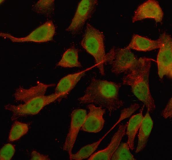 IF analysis of OTUD4 using anti-OTUD4 antibody (A07830-2) and anti-Beta Tubulin antibody (M01857-3)