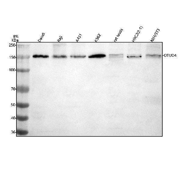 Western blot analysis of OTUD4 using anti-OTUD4 antibody (A07830-2)