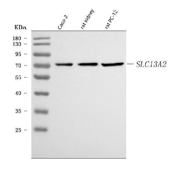  Western blot analysis of NaDC-1/SLC13A2 using anti-NaDC-1/SLC13A2 antibody (A07831-1)