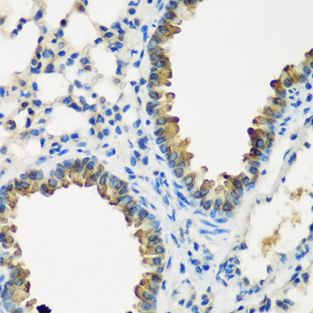 Immunohistochemistry of paraffin-embedded mouse lung using CYP2F1 antibody at dilution of 1:200 (40x lens)