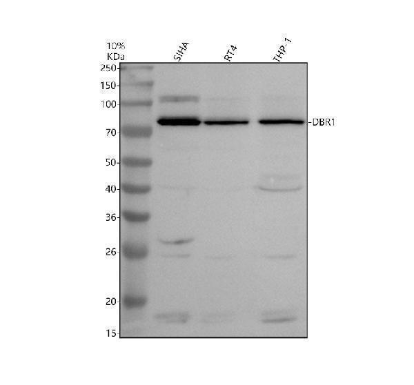 Western blot analysis of DBR1 using anti-DBR1 antibody (A07835-1)