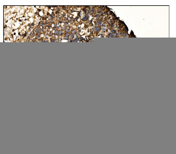  IHC analysis of Arginine Decarboxylase/AZIN2 using anti-Arginine Decarboxylase/AZIN2 antibody (A07836)