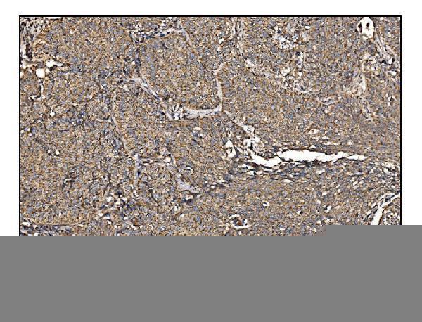 IHC analysis of Arginine Decarboxylase/AZIN2 using anti-Arginine Decarboxylase/AZIN2 antibody (A07836)