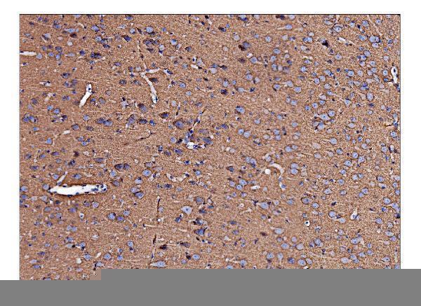 a07836 azin2 primary antibodies ihc testing 4
