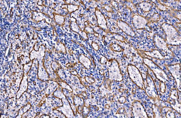  IHC analysis of NLRP7 using anti-NLRP7 antibody (A07838-1)