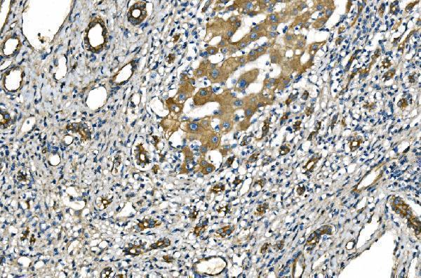  IHC analysis of NLRP7 using anti-NLRP7 antibody (A07838-1)