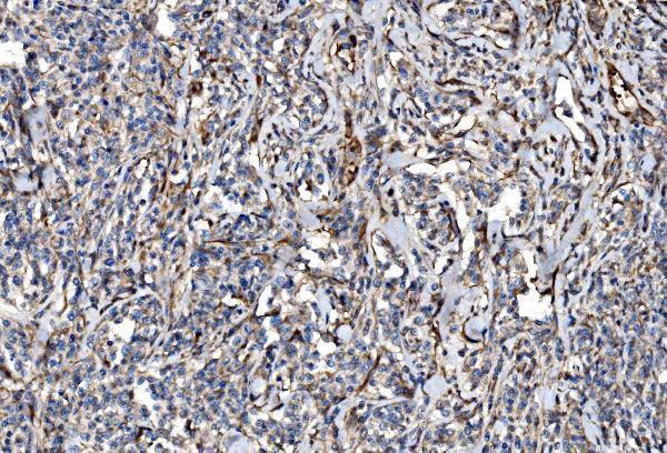 a07838 1 nlrp7 primary antibodies ihc testing 4