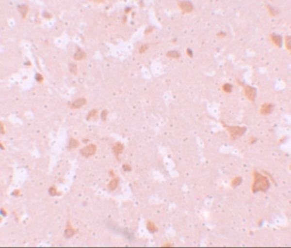 a07838 nlrp7 primary antibodies ihc testing 2