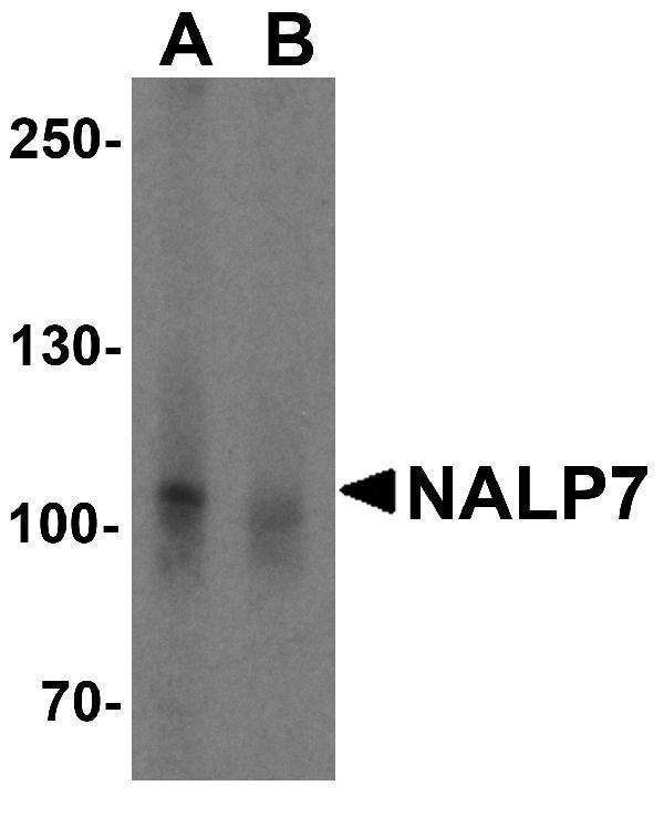 a07838 nlrp7 primary antibodies wb testing 1