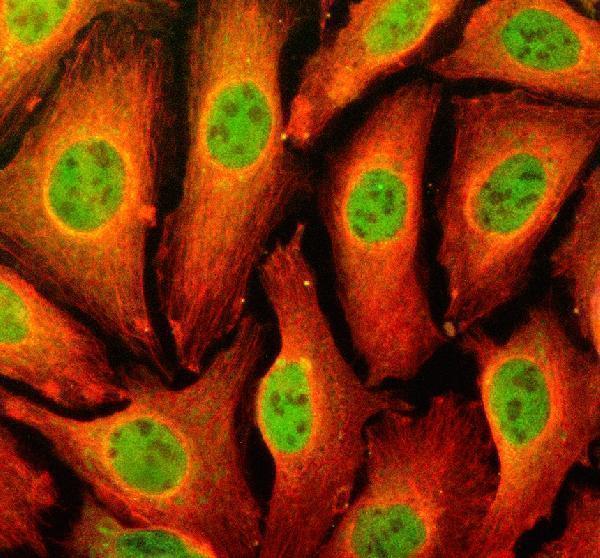 IF analysis of TFEC using anti-TFEC antibody (A07841-3) and anti-Beta Tubulin antibody (M01857-3)