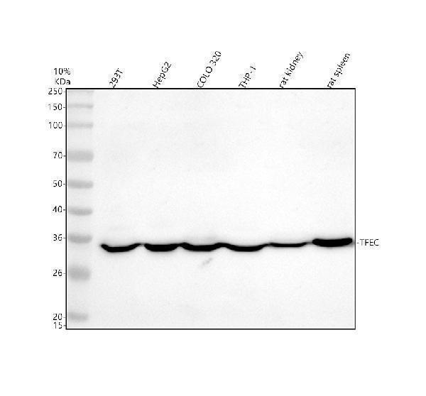 Western blot analysis of TFEC using anti-TFEC antibody (A07841-3)