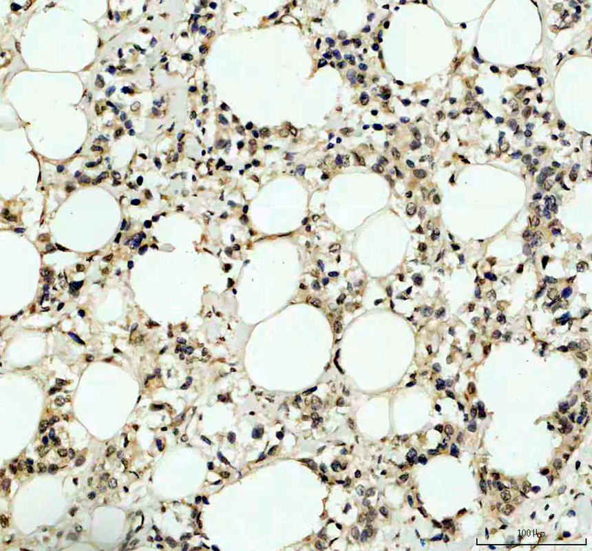 IHC analysis of ITPKC using anti-ITPKC antibody (A07845-1)