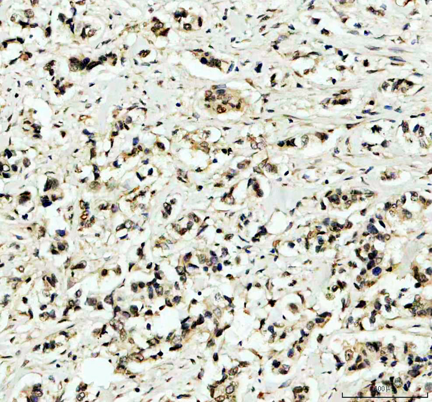 IHC analysis of ITPKC using anti-ITPKC antibody (A07845-1)