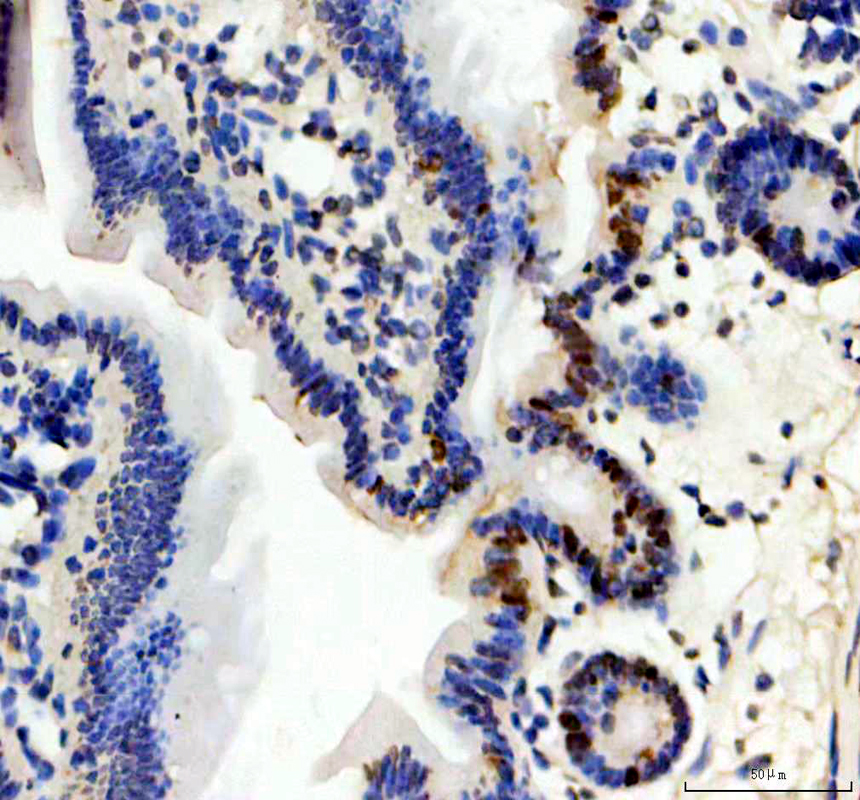 a07845 1 itpkc primary antibodies ihc testing 3